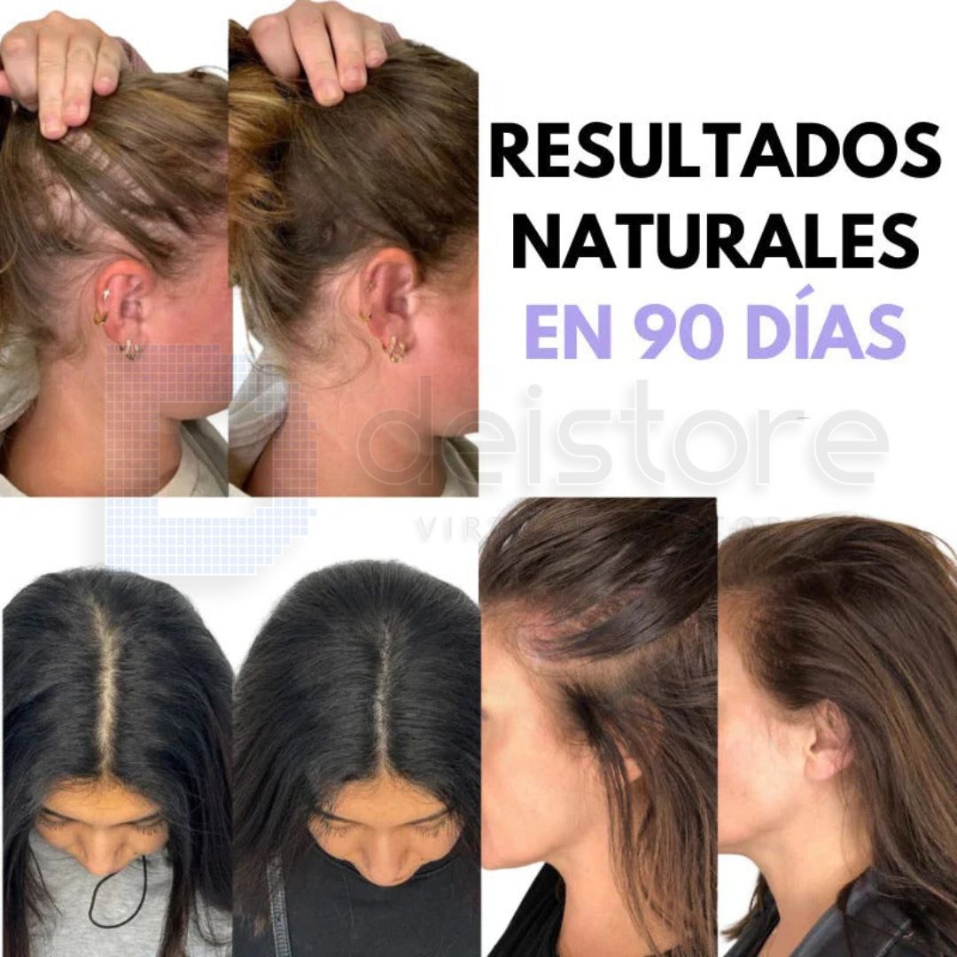 OliBrush Cepillo anticaída 4 en 1